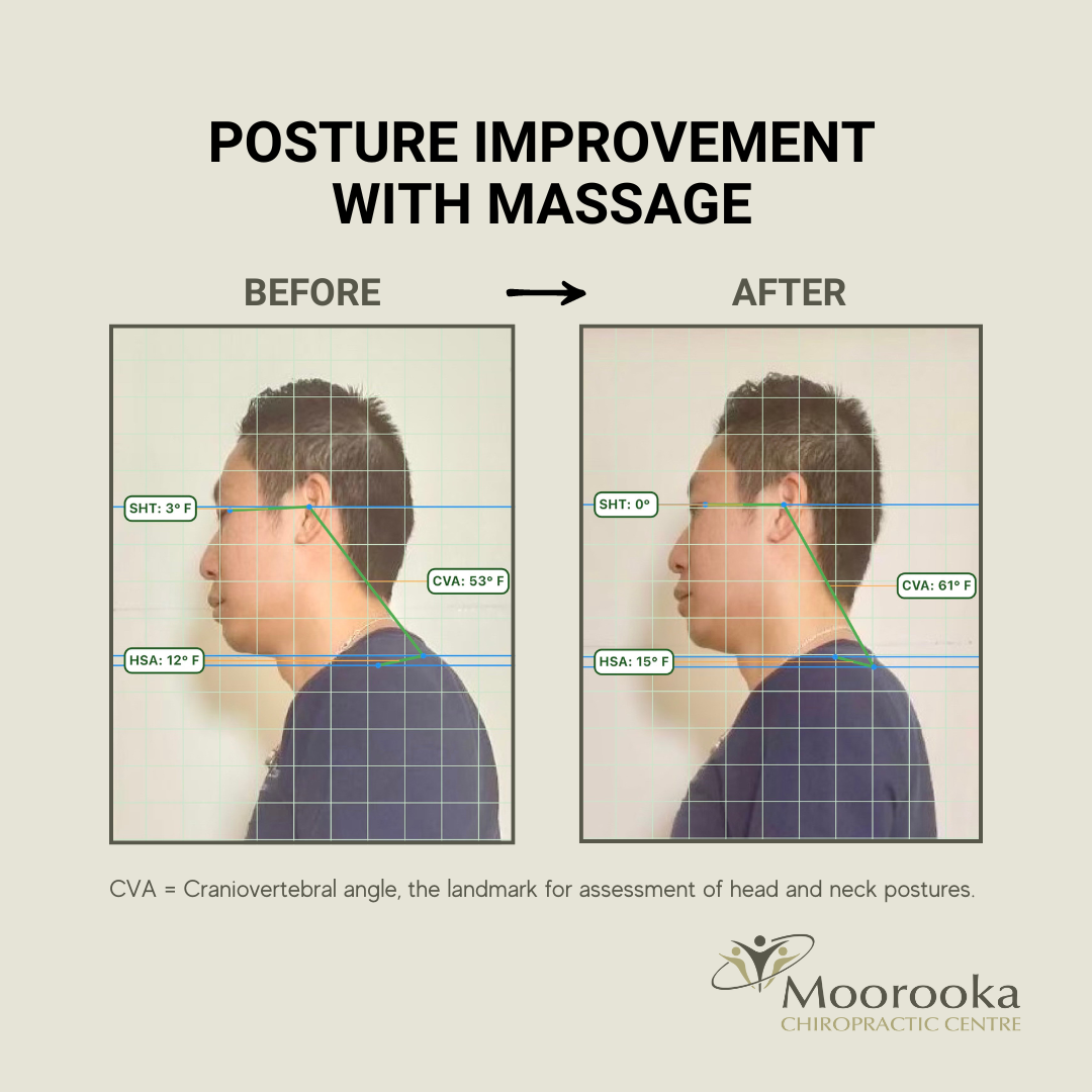 Neck posture improvement